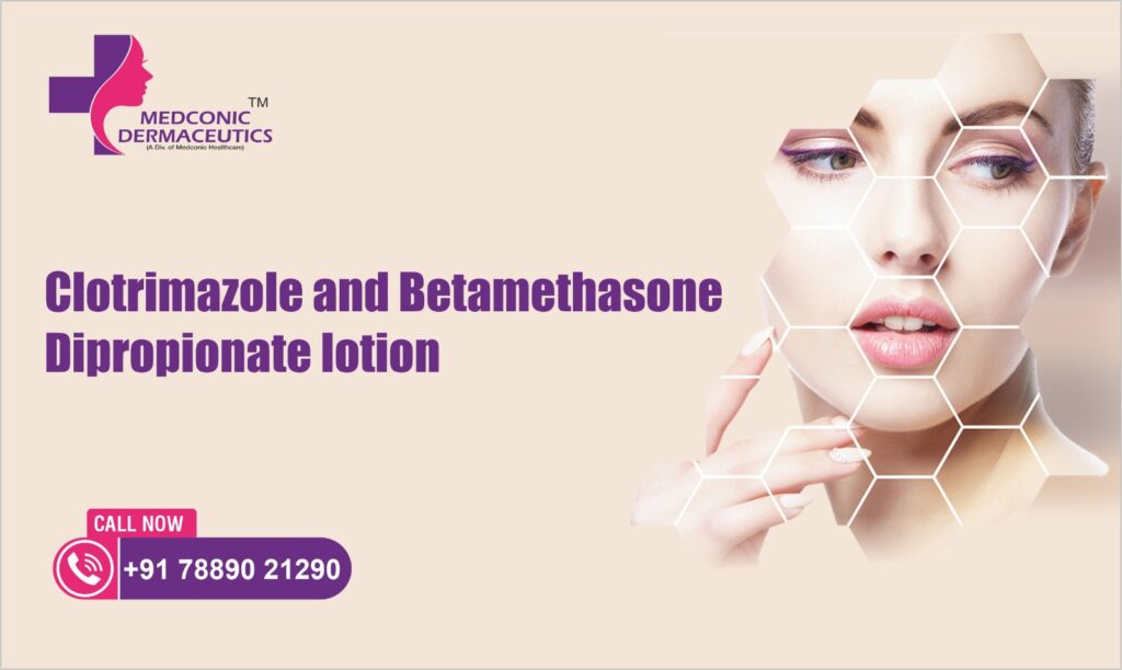 clotrimazole-and-betamethasone-dipropionate-lotion