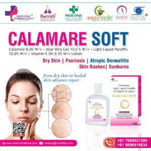 CALAMARE SOFT - Calamine 80% WV Aloe Vera Gel 100 % WV Light Liquid Paraffin 100% WV Vitamin E Oil 05% WV